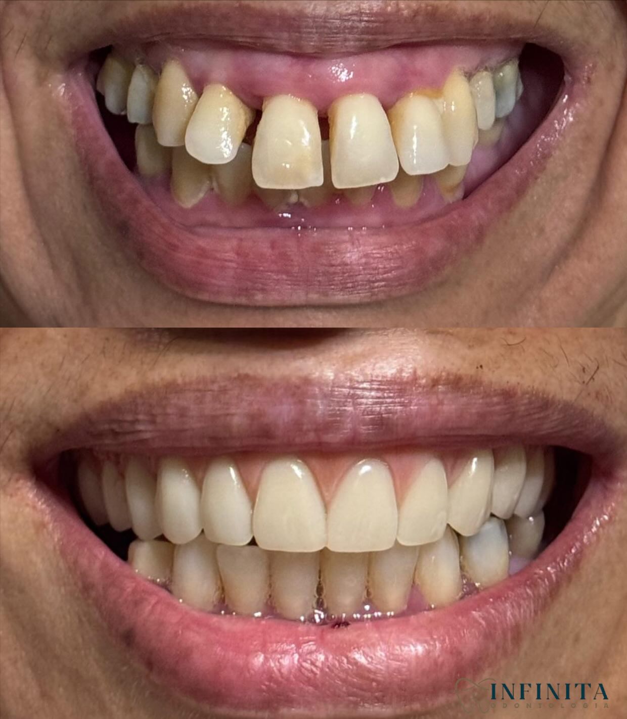 Estética do Sorriso